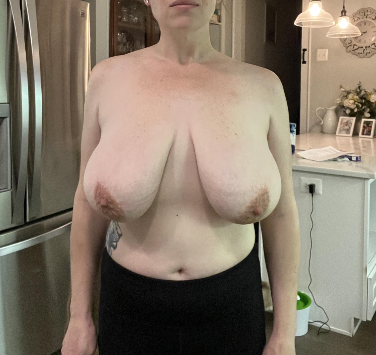 Big Tits Before Reduction 6 #58qTcbQO