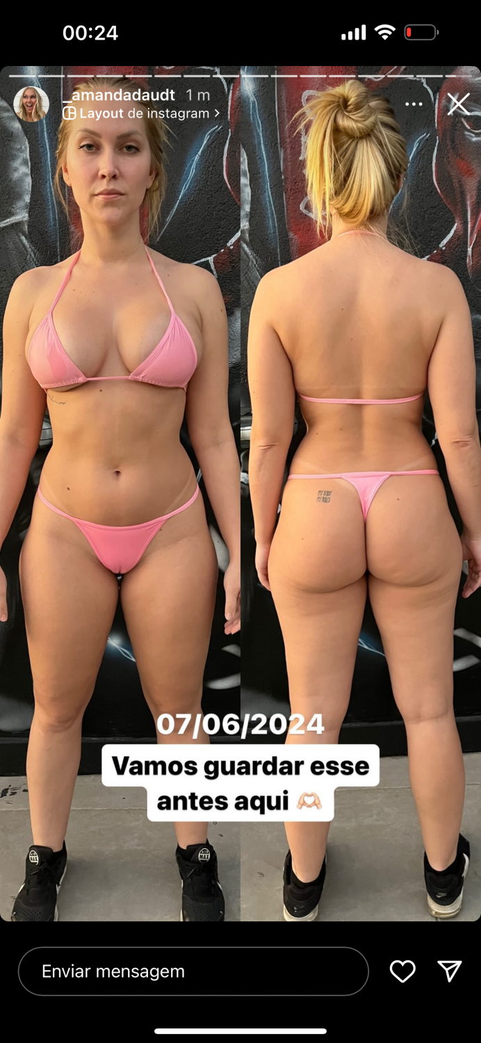 Sweet tits on beautiful model - ∀ɯɐupɐ pɐnpʇ #H4COFQmy