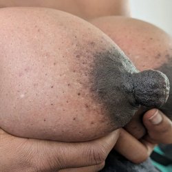 Nipples