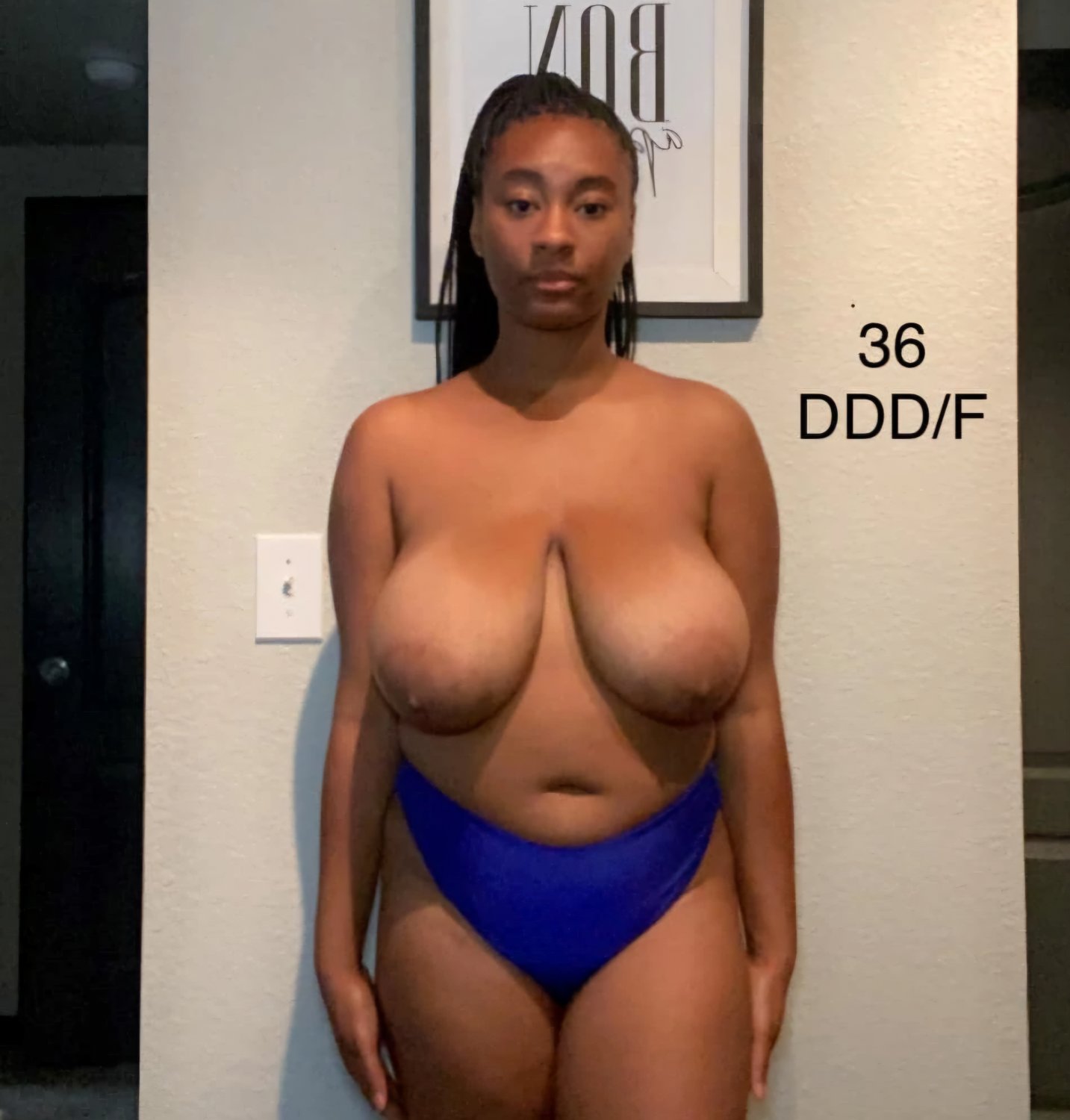 Big Tits Before Reduction 6 #sqibeiuk