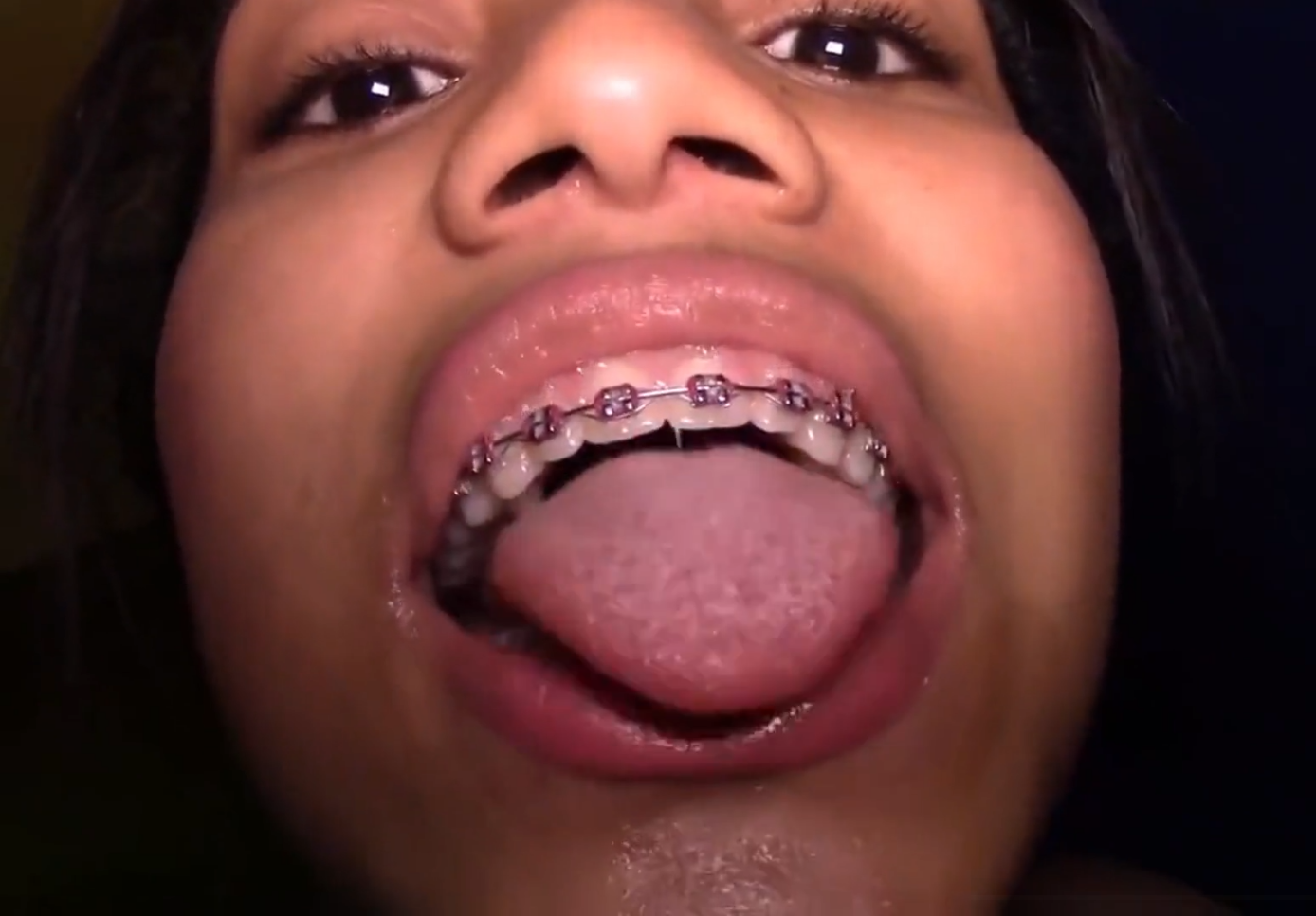 Brace Face Latina Loves Cum & Anal | Ⲣⲟlⲁ.Sⲟl.Ⲣⲟlⲁ on Xham |ᴬᴬ³⁰⁶ #scFAsJLS