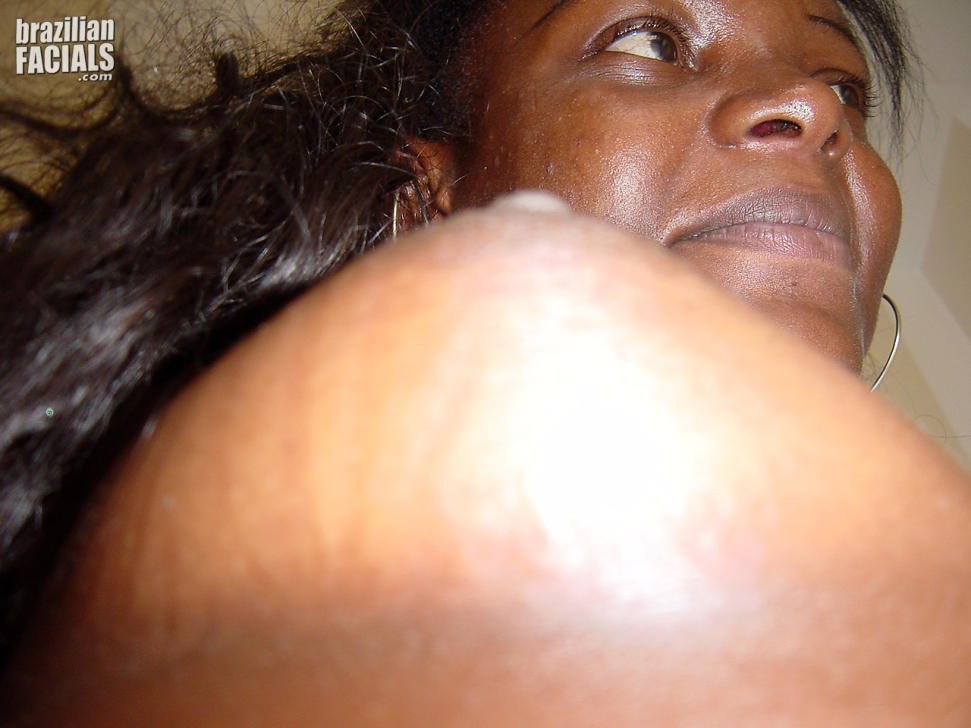 Brazilian Facials #5fCHkdJK