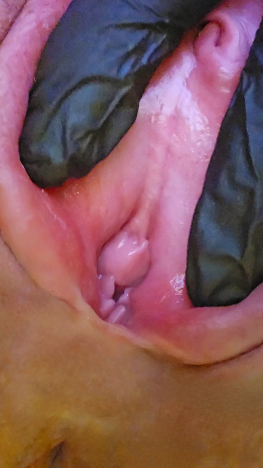 Charlotte spreading her meaty pussy hole open. Her KIK: LickMySwollenPus #JqZHd9aL