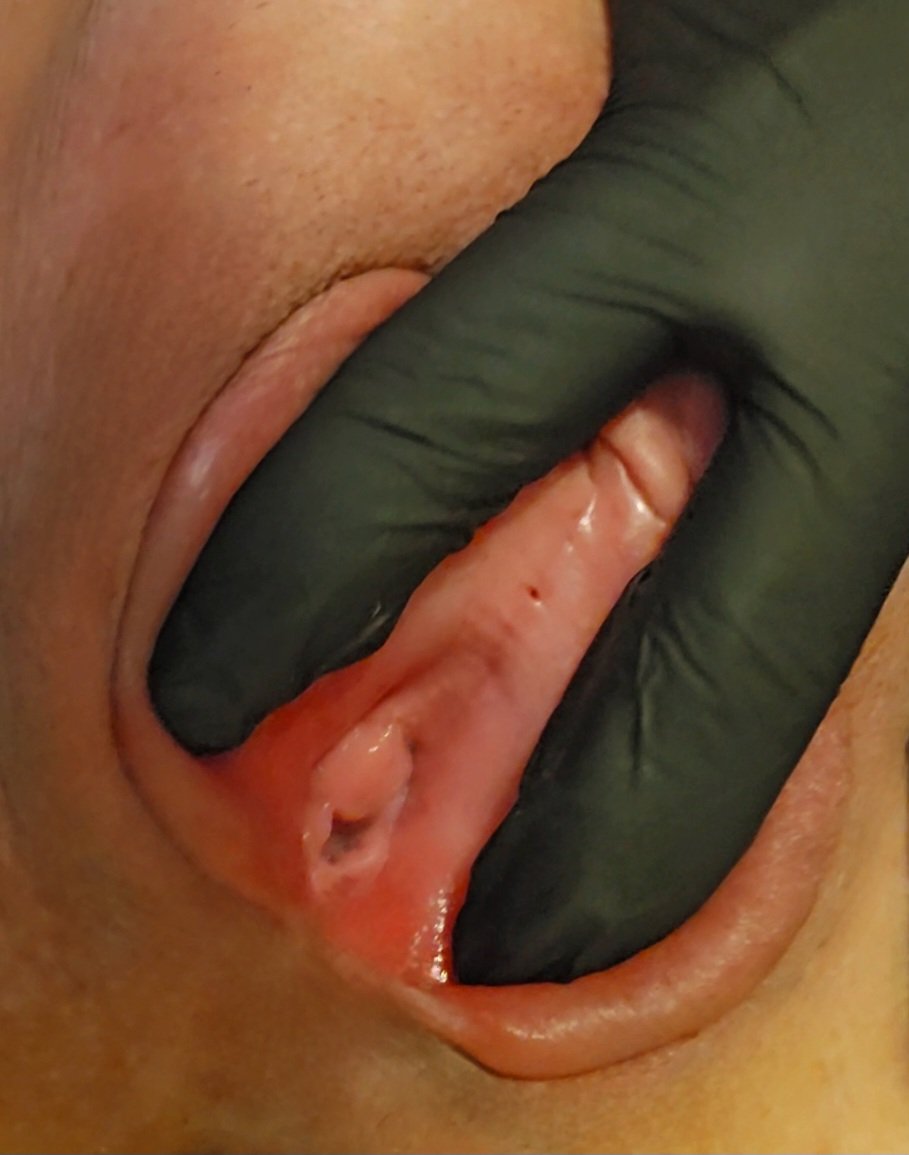 Charlotte spreading open her meaty pussy hole. Her KIK: LickMySwollenPus #qm5fe5AP