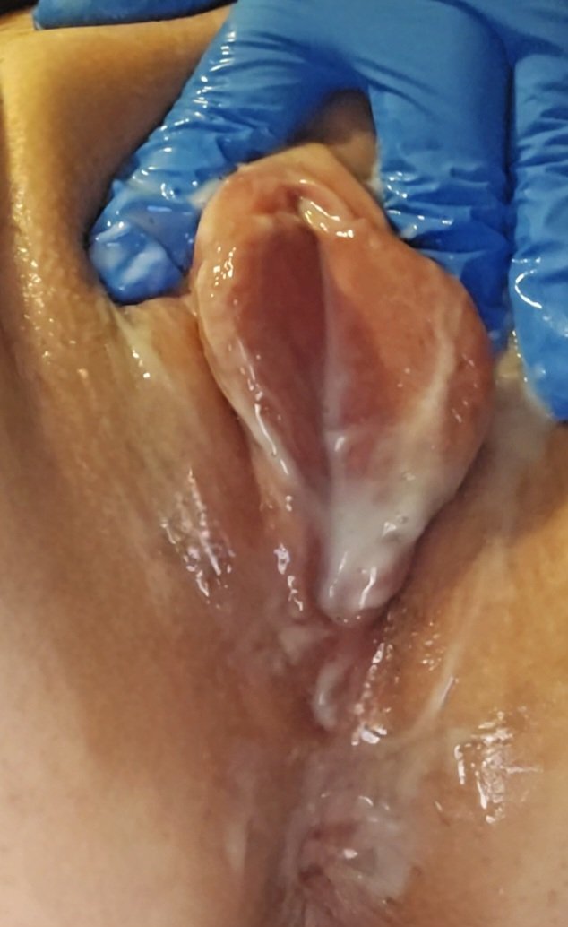 Charlottes swollen pumped pussy. Her KIK: LickMySwollenPus #Ruo01PWg