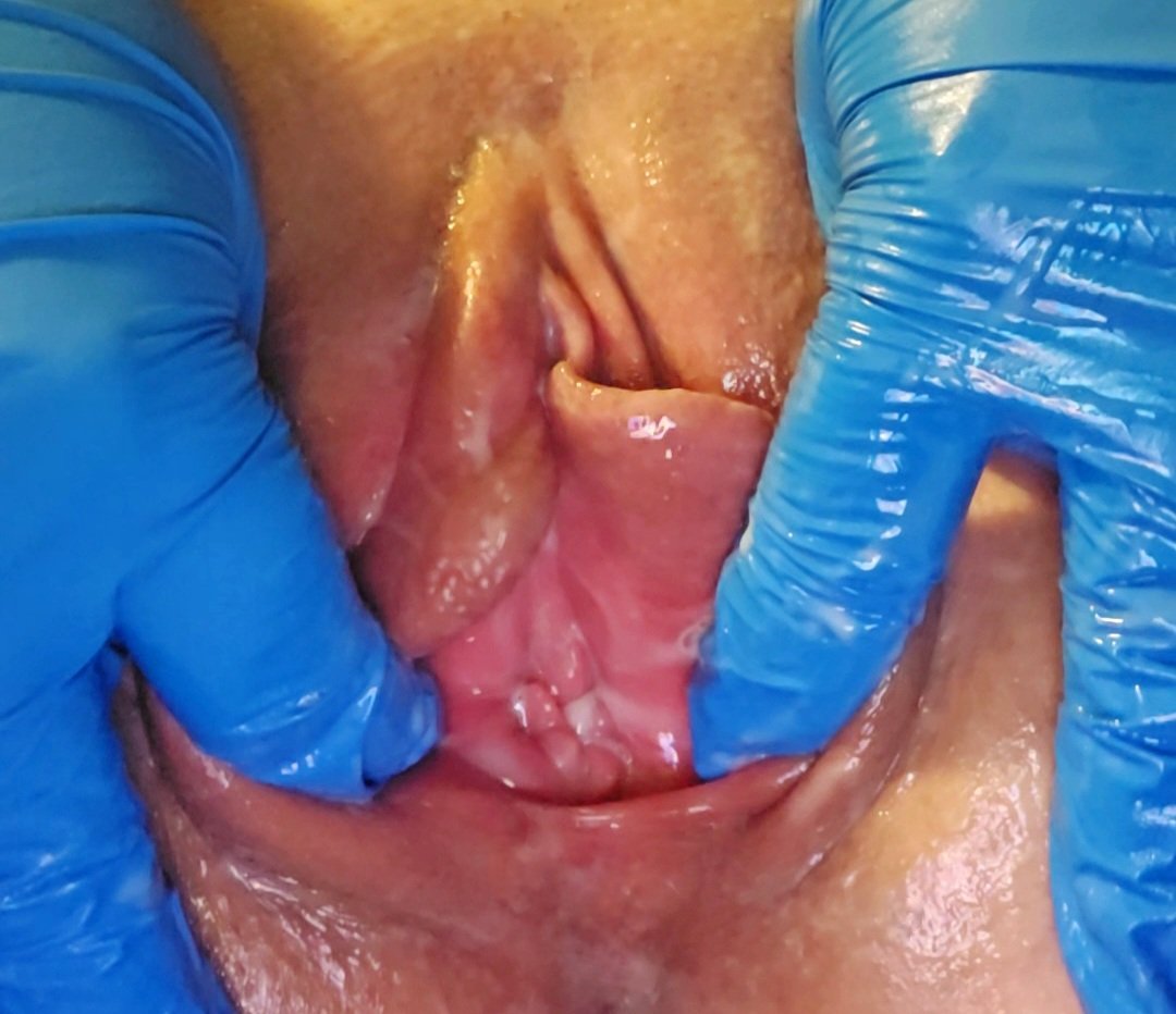 Charlotte spreading her meaty pussy hole open. Her KIK: LickMySwollenPus #XjymC3T0